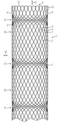 STENT FOR SPLINTING A VEIN, AND SYSTEM FOR PUTTING IN PLACE A STENT