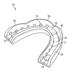 Mouthguard with Magnetic Tethering