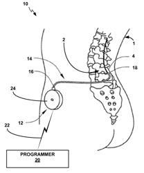 Drug delivery programming techniques