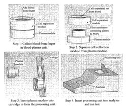 Devices and methods for filtering blood plasma