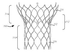 HEART VALVE WITH STENT HAVING VARYING CELL DENSITIES