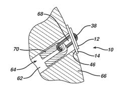 TISSUE FIXATION SYSTEM WITH AUXILIARY PLATE