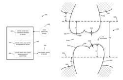 Fabrication of maxillofacial splints