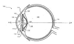 LENS OIL HAVING A NARROW MOLECULAR WEIGHT DISTRIBUTION FOR INTRAOCULAR LENS DEVICES