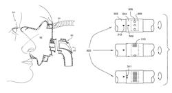 Vent system for CPAP patient interface used in treatment of sleep disordered breathing