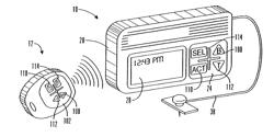 External Infusion Device with Remote Programming, Bolus Estimator and/or Vibration Alarm Capabilities