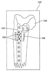 Systems and methods for delivering a medicament