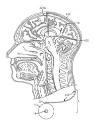 COGNITIVE FUNCTION WITHIN A HUMAN BRAIN