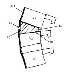 Methods and Apparatus for Performing Spine Surgery