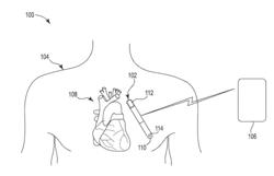 SYSTEMS AND METHODS TO DETERMINE SURROGATES OF BLOOD PRESSURE