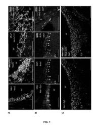 MONOCLONAL ANTIBODY FOR THE DIAGNOSIS, TREATMENT AND/OR PREVENTION OF BRAIN TUMORS AND BRAIN LESIONS