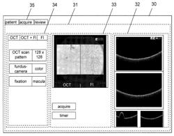 Flexible, multimodal retina image recording system and measurement system