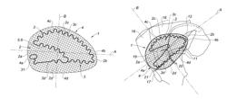 Textile-based prosthesis for treatment of inguinal hernia