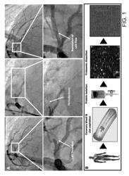 Using nucleic acids encoding NAP-2 and TGF-alpha polypeptides to improve cardiac function