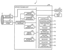 Medical diagnosis apparatus, image processing apparatus, and method for image processing