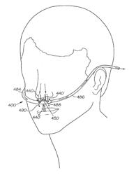 Devices, Systems And Methods For Plethysmographic Monitoring At The Nose