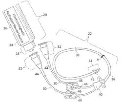 METHODS AND APPARATUS FOR COUPLING AN ELECTROMAGNETIC RADIATION CONDUCTION SYSTEM INTO A CATHETER