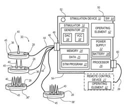 SYSTEM AND METHOD FOR AURICULAR PERIPHERAL NERVE FIELD STIMULATION