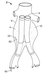 Embolization device and a method of using the same