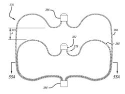 Multiple layer filamentary devices for treatment of vascular defects