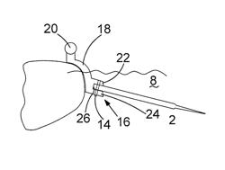 FIN ASSEMBLY FOR A WATER BOARD AND USER PROPELLED WATER BOARD APPARATUS