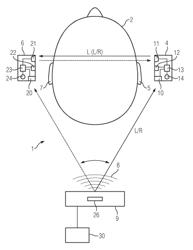 Hearing device for binaural supply and method for its operation