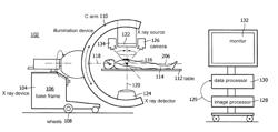 System for detecting global patient movement during imaging procedures