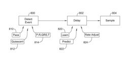 Temporal configuration of a motion sensor in an implantable medical device