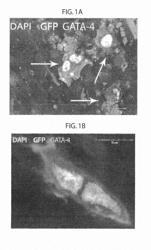 Therapy using cardiac stem cells and mesenchymal stem cells