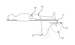 Context-sensitive flow interrupter and drainage outflow optimization system