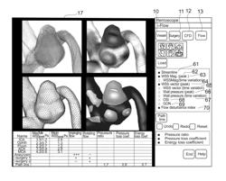 System for diagnosing bloodflow characteristics, method thereof, and computer software program