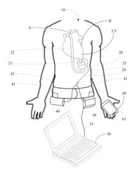 Implantable pump system having an undulating membrane