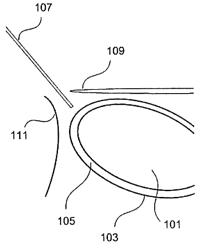 Method for puncturing the pericardial membrane by synchronizing needle advancement with cardiac muscle motion