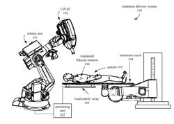 LOCALIZATION ARRAY POSITION IN TREATMENT ROOM COORDINATE SYSTEM