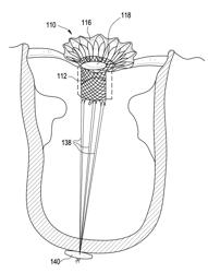 PROSTHETIC VALVES AND RELATED INVENTIONS