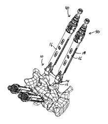 Spinal Fixation System