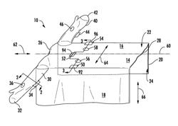 Surgical drape with sleeve and fenestration