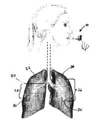 Dry powder formulations for inhalation