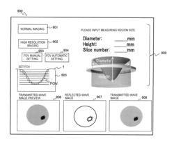 Ultrasonic CT Apparatus