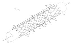 ENDOLUMINAL PROSTHESIS SYSTEMS AND METHODS