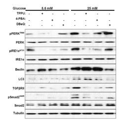 METHODS AND COMPOSITIONS FOR TREATING NEPHROPATHY