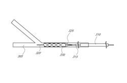 Expandable tip assembly for thrombus management