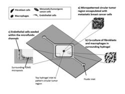 Engineering of a novel breast tumor microenvironment on a microfluidic chip