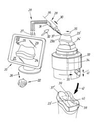 Method and system for coloring or tinting a prosthesis, and such a prosthesis