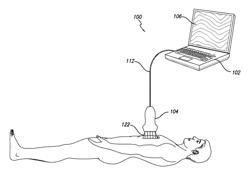 Embedded motion sensing technology for integration within commercial ultrasound probes