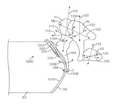 TRANSDUCER DEVICES AND METHODS FOR HEARING