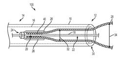 STENT DELIVERY SYSTEM AND METHOD