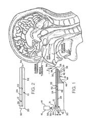 Method for transnasal delivery of blood-brain barrier permeation agent and therapeutic agent