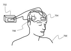 METHOD FOR LOW LATENCY AUTOMATED CLOSED-LOOP SYNCHRONIZATION OF NEUROSTIMULATION INTERVENTIONS TO NEUROPHYSIOLOGICAL ACTIVITY