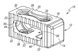 Cervical and lumbar spinal interbody devices